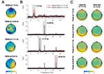 Effect of sustained selective attention on steady-state visual evoked potentials